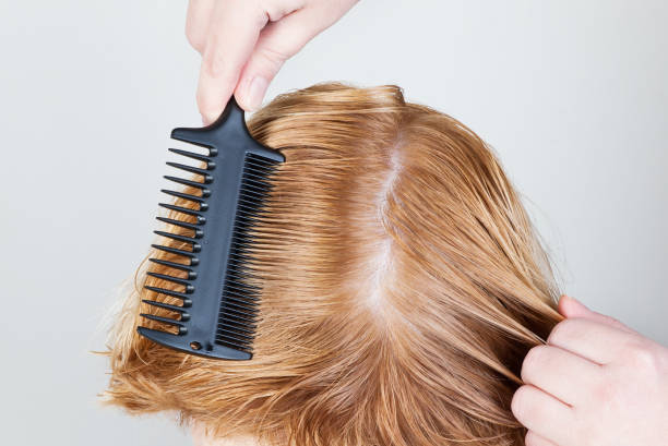 艾伦耶格尔发型怎么减，为什么理发师不建议剪平头